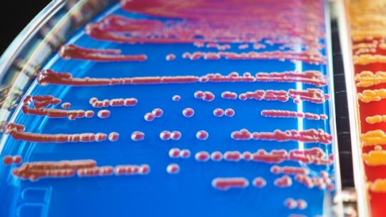 Microbiote intestinal: ce que vous devez vraiment savoir